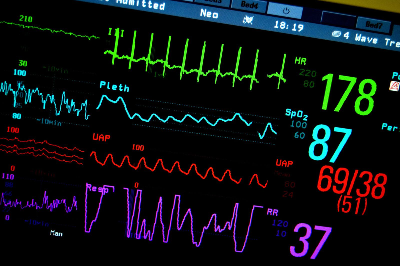 Monitoring in Azure
